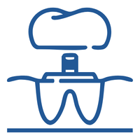 Blue line art icon showing a tooth with a crown on top, representing dental implants or dentistry services
