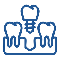 Icon showing three teeth with dental implants in a blue tray.